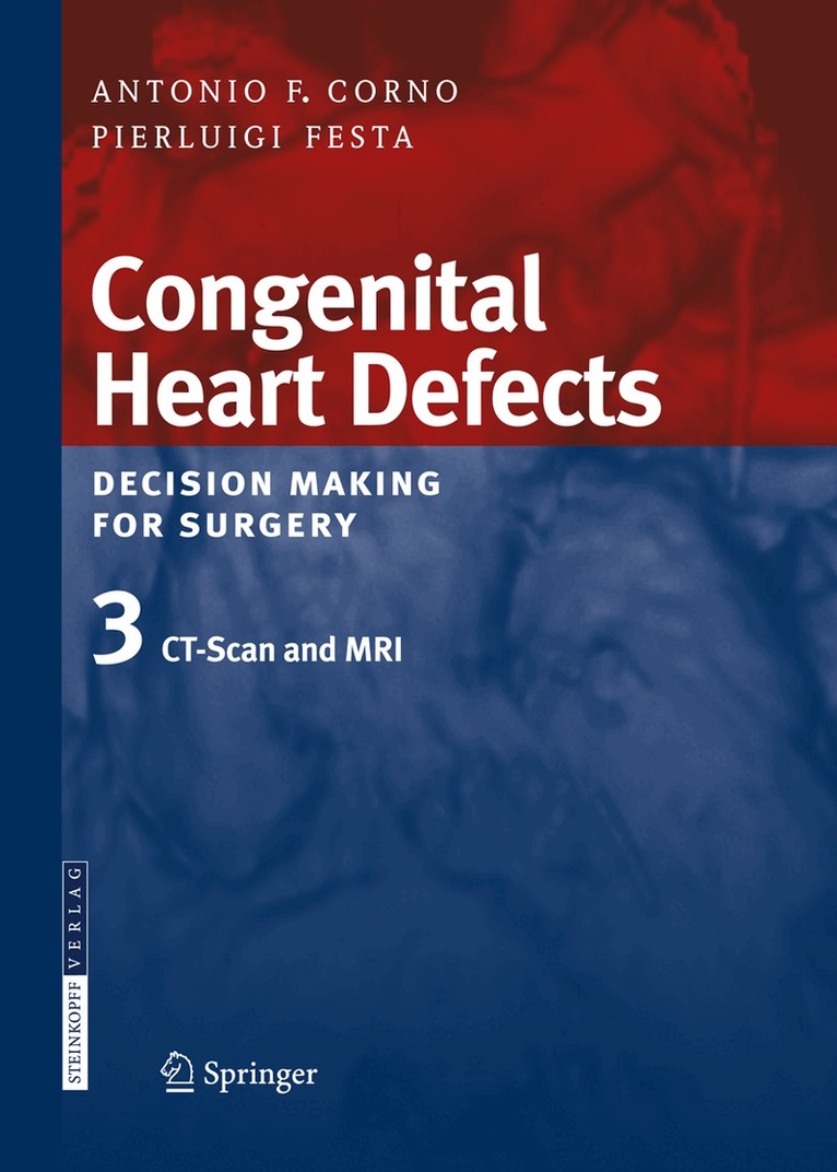 Antonio F. Corno, Pierluigi Festa - Congenital Heart Defects. Decision Making for Surgery, Häftad. Tillgänglighet: Lägg i varukorg
