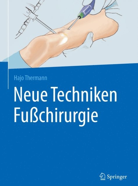 Hajo Thermann - Neue Techniken Fußchirurgie, E-bok