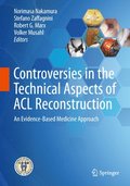 Controversies in the Technical Aspects of ACL Reconstruction