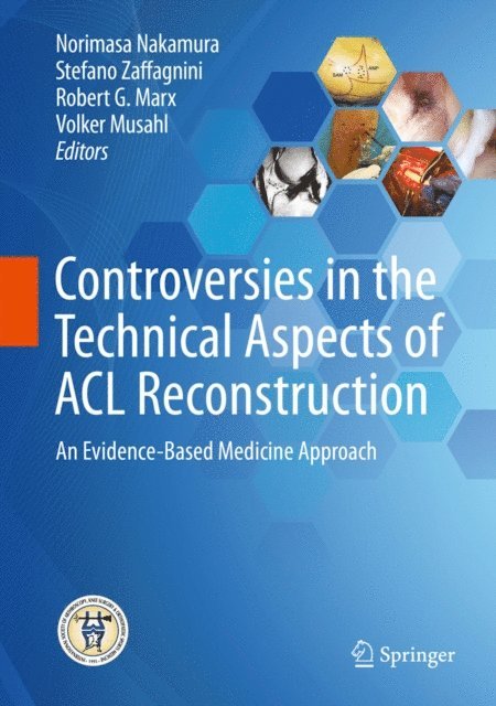 Volker Musahl, Robert G. Marx, Stefano Zaffagnini, Norimasa Nakamura - Controversies in the Technical Aspects of ACL Reconstruction, E-bok