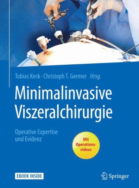 Christoph T. Germer, Tobias Keck - Minimalinvasive Viszeralchirurgie, E-bok