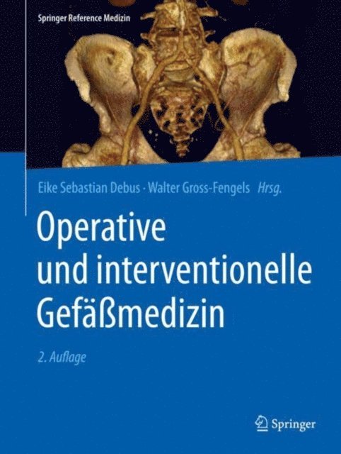 Walter Gross-Fengels, Eike Sebastian Debus - Operative und interventionelle Gefäßmedizin, E-bok