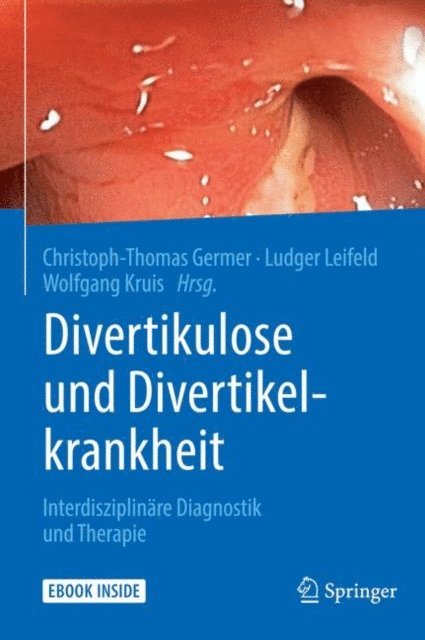 Wolfgang Kruis, Ludger Leifeld, Christoph-Thomas Germer - Divertikulose und Divertikelkrankheit, E-bok