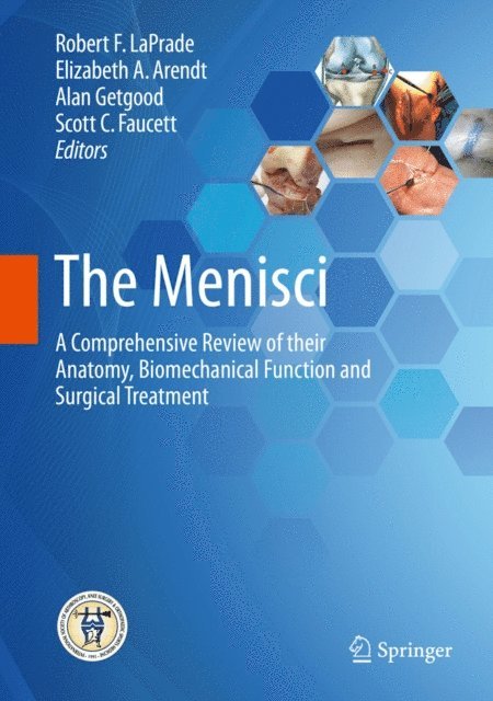 Scott C. Faucett, Alan Getgood, Elizabeth A. Arendt, Robert F. LaPrade - Menisci, E-bok
