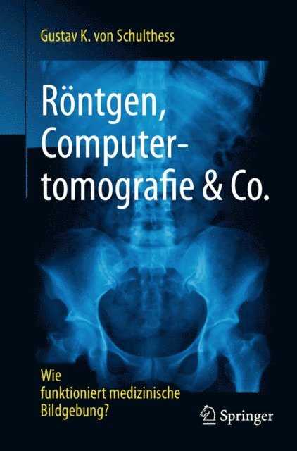 Gustav K. von Schulthess - Röntgen, Computertomografie & Co., E-bok