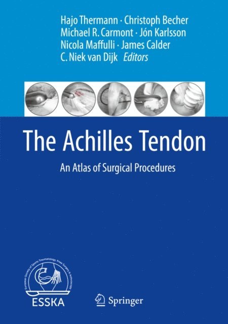 C. Niek van Dijk, James Calder, Nicola Maffulli, Jon Karlsson, Michael R. Carmont, Christoph Becher, Hajo Thermann - Achilles Tendon, E-bok