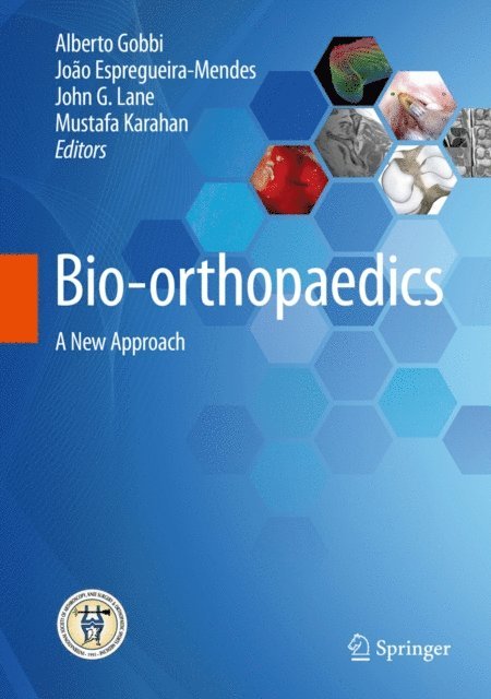 Mustafa Karahan, John G. Lane, Joao Espregueira-Mendes, Alberto Gobbi - Bio-orthopaedics, E-bok