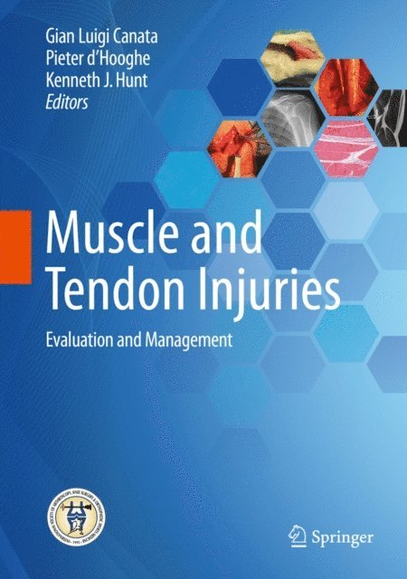 Kenneth J. Hunt, Pieter d'Hooghe, Gian Luigi Canata - Muscle and Tendon Injuries, E-bok