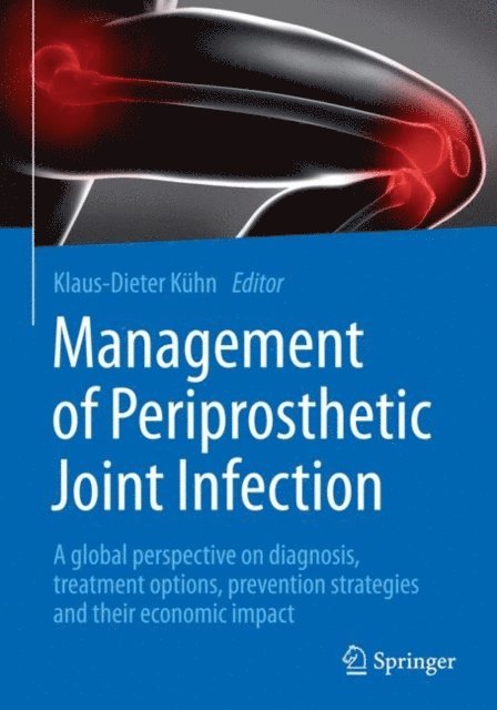 Klaus-Dieter Kuhn - Management of Periprosthetic Joint Infection, E-bok