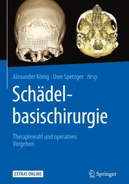 Uwe Spetzger, Alexander Konig - Schädelbasischirurgie, E-bok