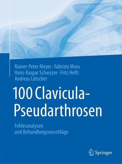 Fritz Hefti, Hans-Kaspar Schwyzer, Fabrizio Moro, Rainer-Peter Meyer - 100 Clavicula-Pseudarthrosen, E-bok