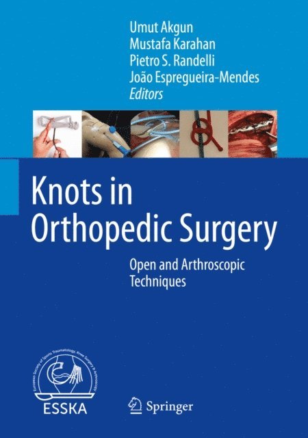 Joao Espregueira-Mendes, Pietro S. Randelli, Mustafa Karahan, Umut Akgun - Knots in Orthopedic Surgery, E-bok