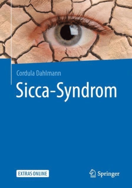 Cordula Dahlmann - Sicca-Syndrom, E-bok