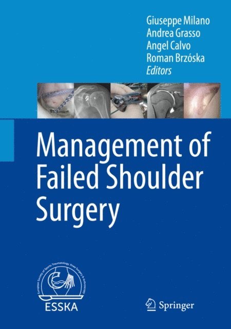 Roman Brzoska, Angel Calvo, Andrea Grasso, Giuseppe Milano - Management of Failed Shoulder Surgery, E-bok