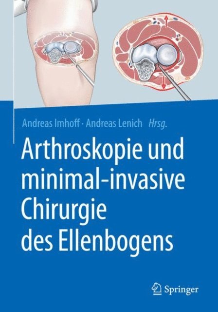 Andreas Lenich, Andreas B. Imhoff - Arthroskopie und minimal-invasive Chirurgie des Ellenbogens, E-bok