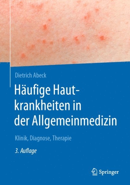 Dietrich Abeck - Häufige Hautkrankheiten in der Allgemeinmedizin, E-bok