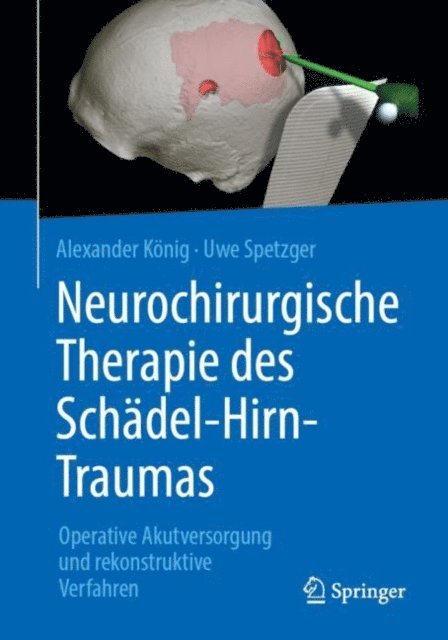 Uwe Spetzger, Alexander Konig - Neurochirurgische Therapie des Schädel-Hirn-Traumas, E-bok