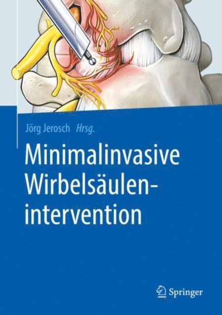 Jorg Jerosch - Minimalinvasive Wirbelsäulenintervention, E-bok