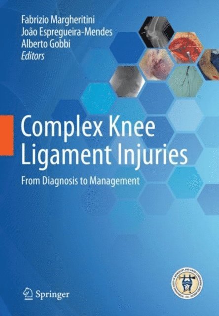 Alberto Gobbi, Joao Espregueira-Mendes, Fabrizio Margheritini - Complex Knee Ligament Injuries, E-bok