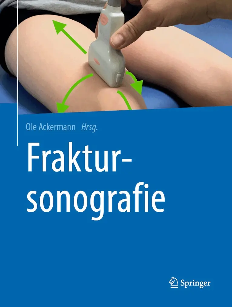 Ole Ackermann - Fraktursonografie, Inbunden. Tillgänglighet: Lägg i varukorg