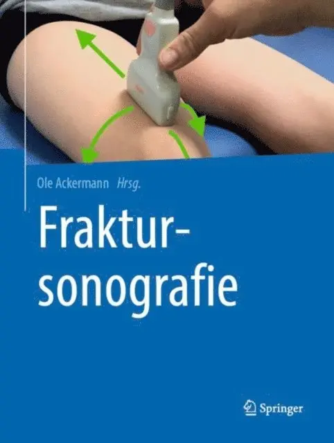 Ole Ackermann - Fraktursonografie, E-bok. Tillgänglighet: Lägg i varukorg