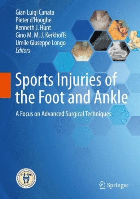 Umile Giuseppe Longo, Gino M.M.J. Kerkhoffs, Kenneth J. Hunt, Pieter d'Hooghe, Gian Luigi Canata - Sports Injuries of the Foot and Ankle, E-bok