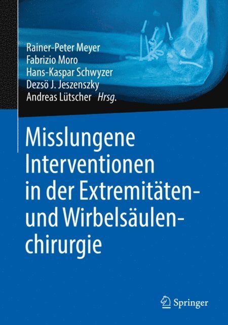 Dezso J. Jeszenszky, Hans-Kaspar Schwyzer, Fabrizio Moro, Rainer-Peter Meyer - Misslungene Interventionen in der Extremitäten- und Wirbelsäulenchirurgie, E-bok