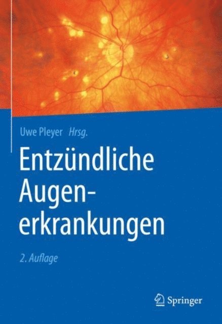Uwe Pleyer - Entzündliche Augenerkrankungen, E-bok
