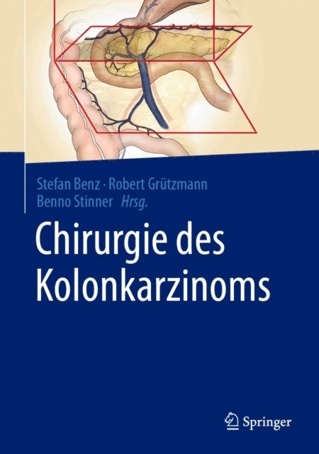 Benno Stinner, Robert Grutzmann, Stefan Benz - Chirurgie des Kolonkarzinoms, E-bok