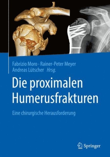 Andreas Lutscher, Rainer-Peter Meyer, Fabrizio Moro - Die proximalen Humerusfrakturen, E-bok