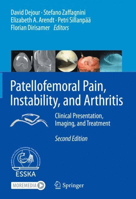 Florian Dirisamer, Petri Sillanpaa, Elizabeth A. Arendt, Stefano Zaffagnini, David Dejour - Patellofemoral Pain, Instability, and Arthritis, E-bok