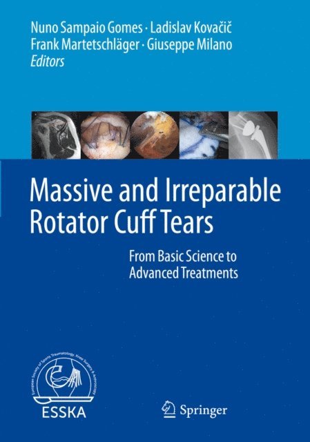 Giuseppe Milano, Frank Martetschlager, Ladislav Kovacic, Nuno Sampaio Gomes - Massive and Irreparable Rotator Cuff Tears, E-bok