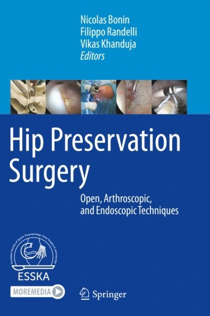 Vikas Khanduja, Filippo Randelli, Nicolas Bonin - Hip Preservation Surgery, E-bok. Tillgänglighet: Lägg i varukorg