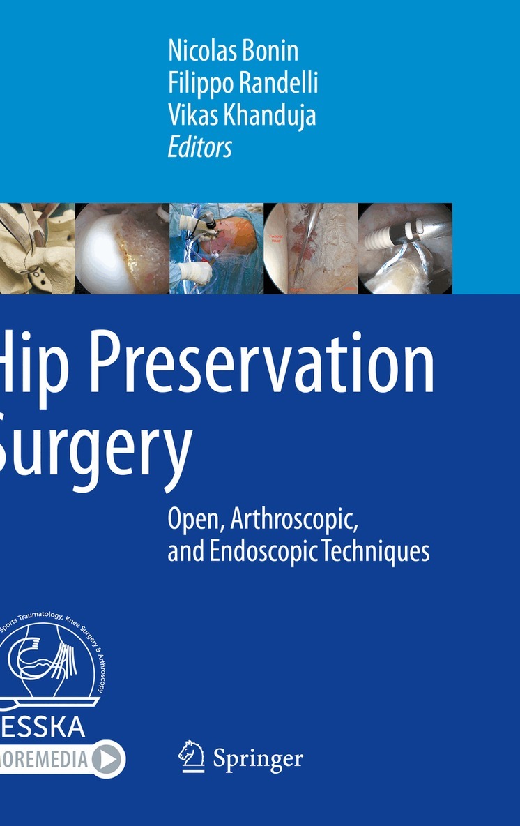 Nicolas Bonin, Filippo Randelli, Vikas Khanduja - Hip Preservation Surgery, Häftad. Tillgänglighet: Lägg i varukorg