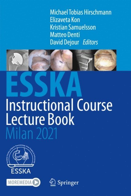 David Dejour, Matteo Denti, Kristian Samuelsson, Elizaveta Kon, Michael Tobias Hirschmann - ESSKA Instructional Course Lecture Book, E-bok