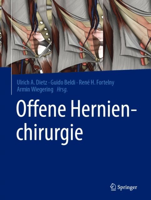 Armin Wiegering, Rene H. Fortelny, Guido Beldi, Ulrich A. Dietz - Offene Hernienchirurgie, E-bok