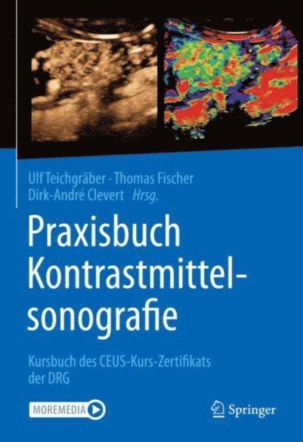 Dirk-Andre Clevert, Thomas Fischer, Ulf Teichgraber - Praxisbuch Kontrastmittelsonografie, E-bok