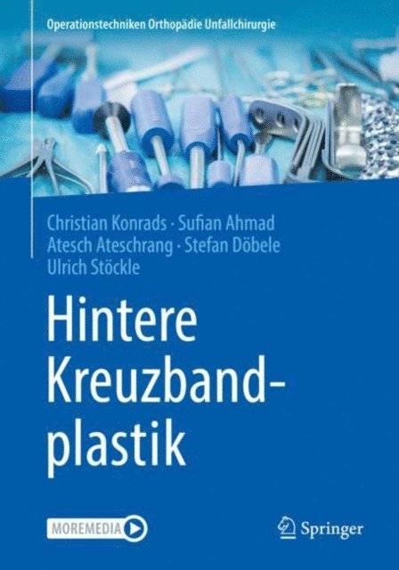 Ulrich Stockle, Stefan Dobele, Atesch Ateschrang, Sufian Ahmad, Christian Konrads - Hintere Kreuzbandplastik, E-bok