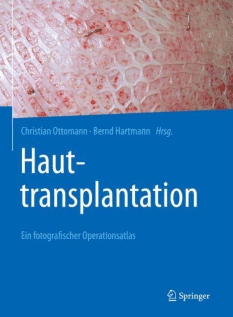 Bernd Hartmann, Christian Ottomann - Hauttransplantation, E-bok