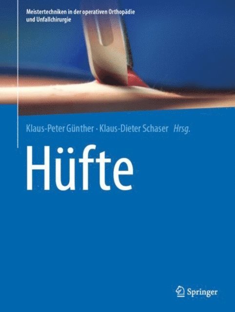 Klaus-Dieter Schaser, Klaus-Peter Gunther - Hüfte, E-bok