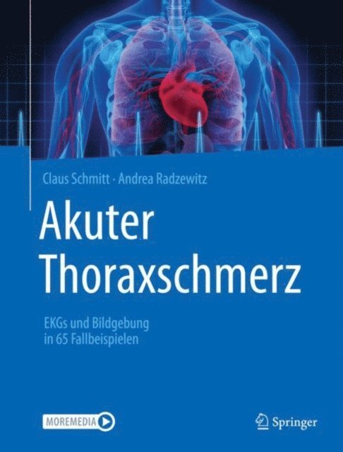 Andrea Radzewitz, Claus Schmitt - Akuter Thoraxschmerz, E-bok