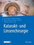 Katarakt- und Linsenchirurgie