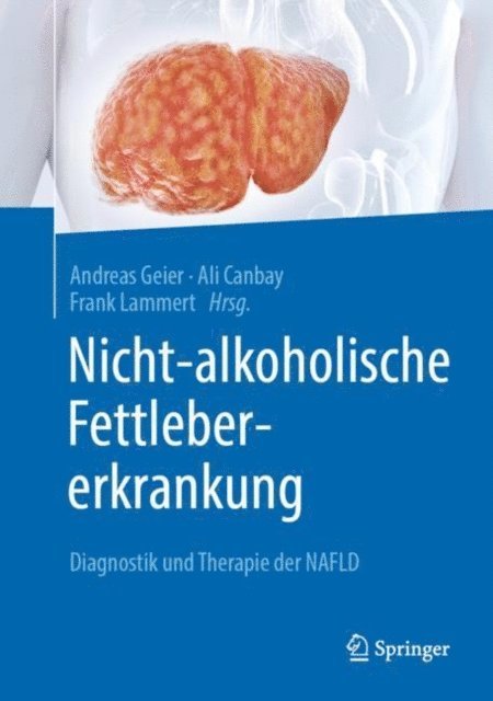 Frank Lammert, Ali Canbay, Andreas Geier - Nicht-alkoholische Fettlebererkrankung, E-bok