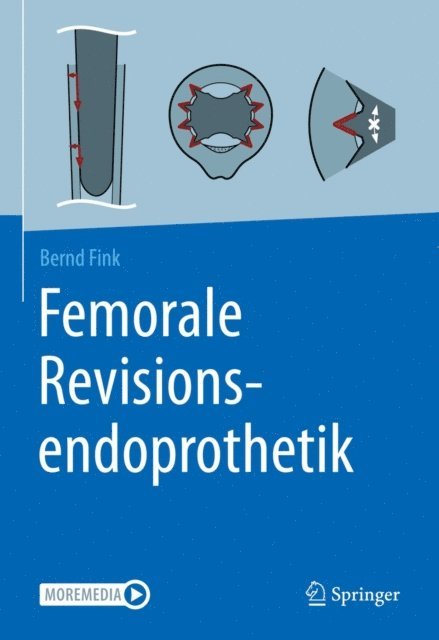 Bernd Fink - Femorale Revisionsendoprothetik, E-bok. Tillgänglighet: Lägg i varukorg
