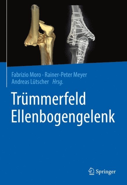 Andreas Lutscher, Rainer-Peter Meyer, Fabrizio Moro - Trümmerfeld Ellenbogengelenk, E-bok