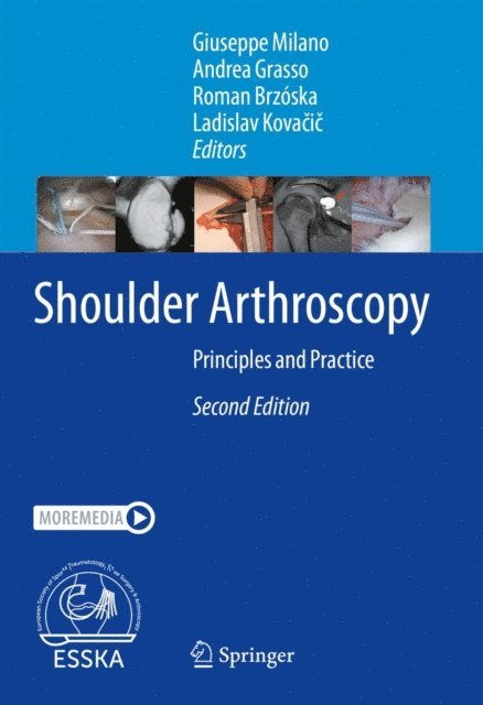 Ladislav Kovacic, Roman Brzoska, Andrea Grasso, Giuseppe Milano - Shoulder Arthroscopy, E-bok
