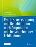Prothesenversorgung und Rehabilitation nach Amputation und bei angeborener Fehlbildung