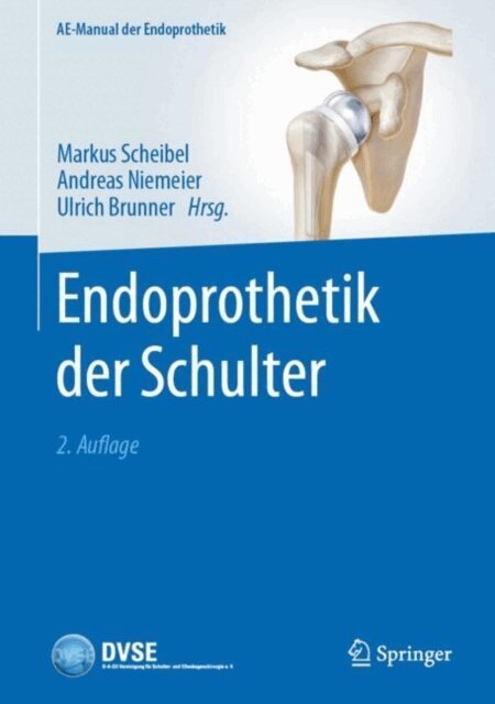 Ulrich Brunner, Andreas Niemeier, Markus Scheibel - Endoprothetik der Schulter, E-bok