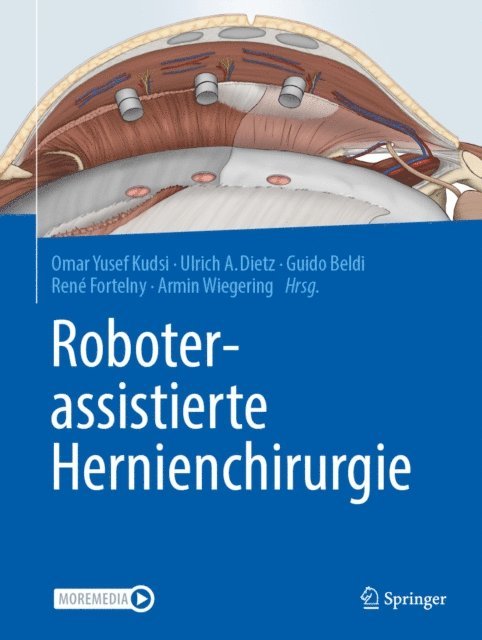 Armin Wiegering, Rene Fortelny, Guido Beldi, Ulrich A. Dietz, Omar Yusef Kudsi - Roboterassistierte Hernienchirurgie, E-bok