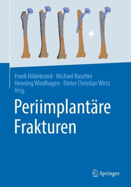 Dieter Christian Wirtz, Henning Windhagen, Michael J. Raschke, Frank Hildebrand - Periimplantäre Frakturen, E-bok